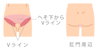 恵生会クリニック陰部脱毛